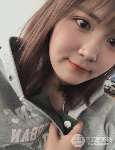 埋线双眼皮以后的护理