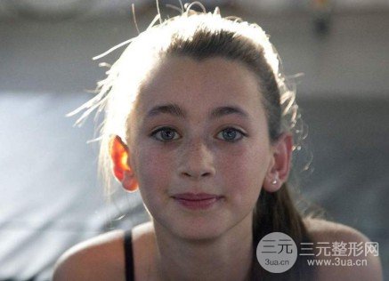 激光祛除黄褐斑会复发吗