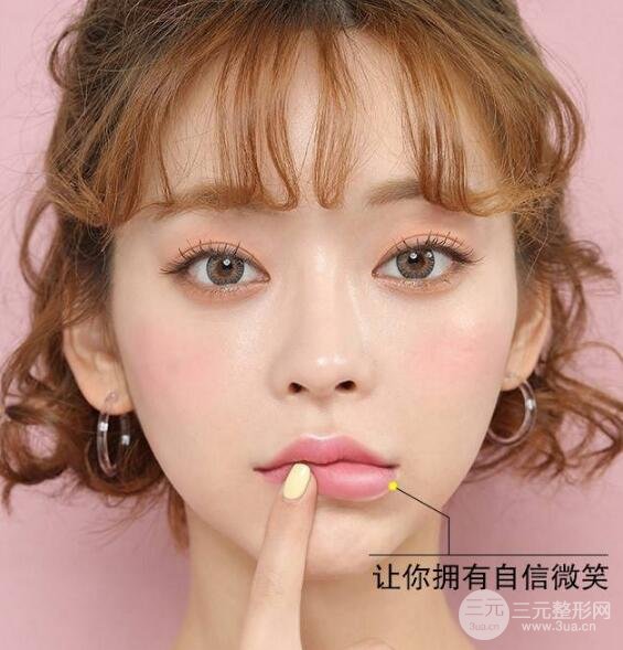 兔唇修复后图片