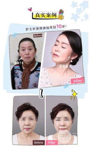 美版热拉提和韩版的区别