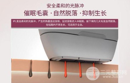 复合彩光脱毛和激光脱毛一样吗