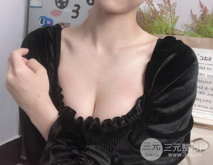 水滴型假体隆胸一年后