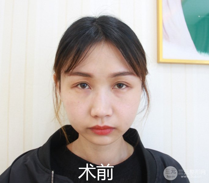 香肠眼