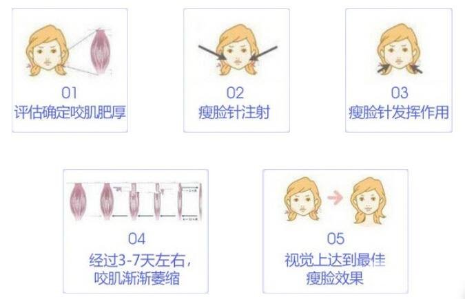 打注射瘦脸之后会有危害吗