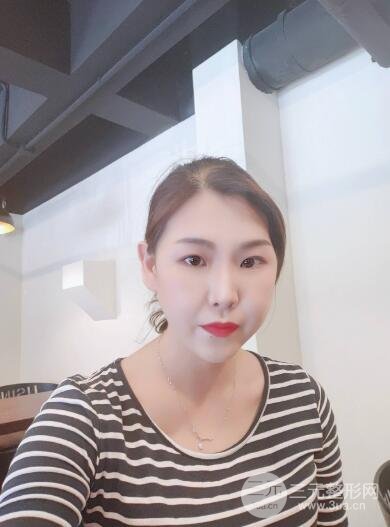 光子嫩肤两个月之后