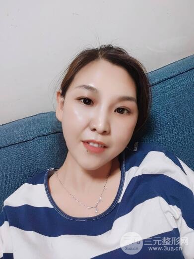 做完5次光子嫩肤之后