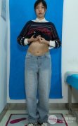 腰腹环吸亲身经历，后悔自己没有早点去做！