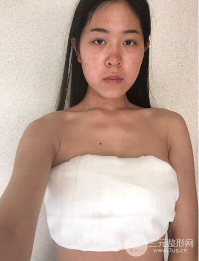决定做手术