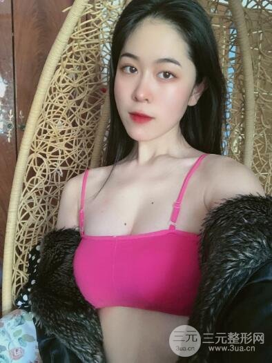术后