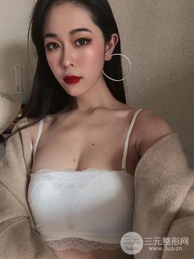 术后