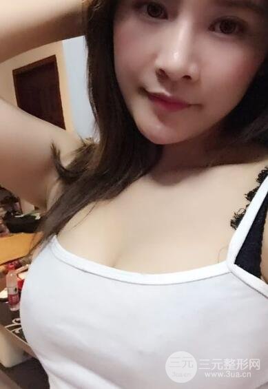 手术后34年