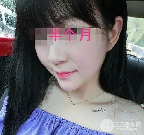 手术前的准备