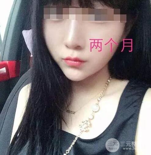手术后