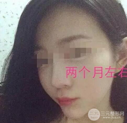 手术后