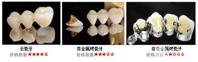 金合金內冠烤瓷牙