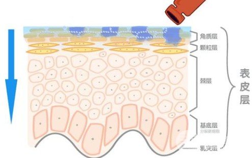 玻尿酸去除法令纹好吗