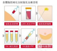 打丰胸针和假体哪个好?可能有哪些不良反应?