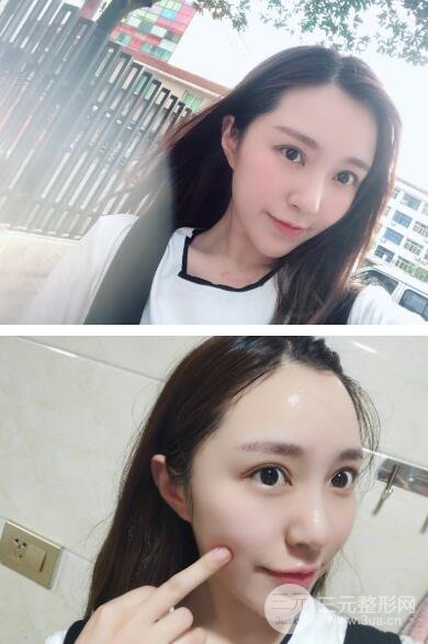 术后