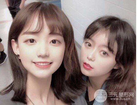 眼角开大整形手术