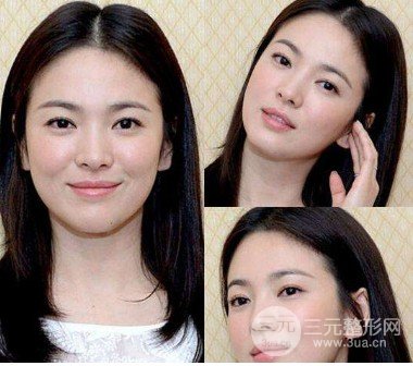 自体脂肪填充眼窝的危险因素