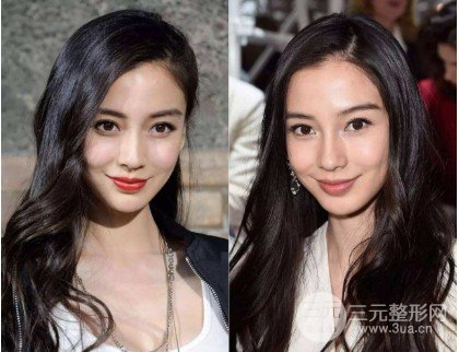 自体脂肪填充眼窝的危险因素