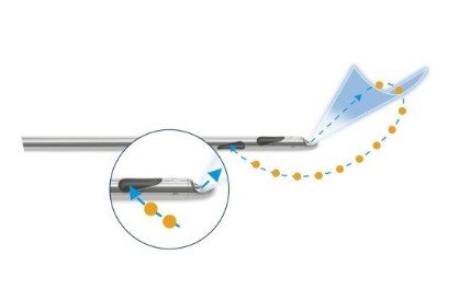 腰腹部吸脂手术后多久能运动