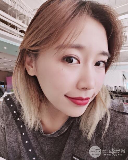 激光祛痘恢复过程图分享