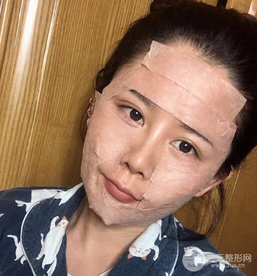 面部填充