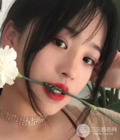 双眼皮宽度6mm