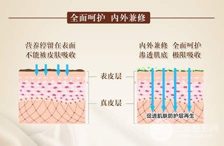 缓解红血丝大概多少钱