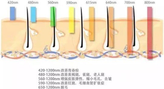 光子嫩肤多久做一次