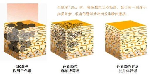 老年斑的消除方法