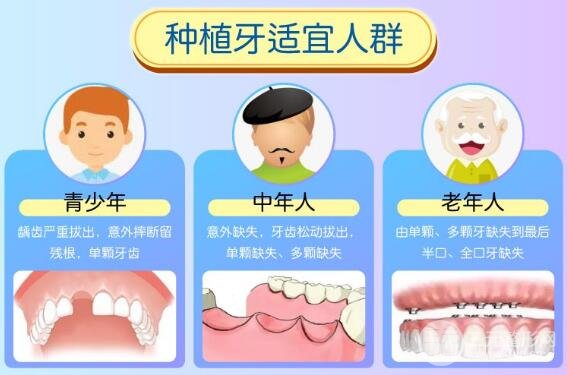 种植牙价格表图
