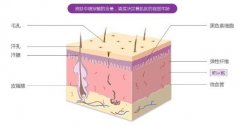 玻尿酸的果:看看这个美容神器能带来哪些功? 玻尿酸的果:看看这个美容神器能带来哪些功?
