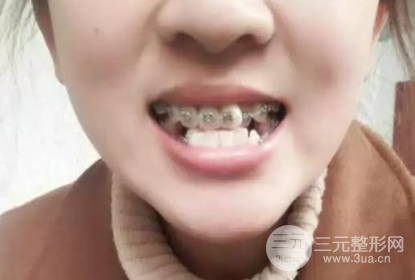 邵阳雅贝康口腔医院价目表