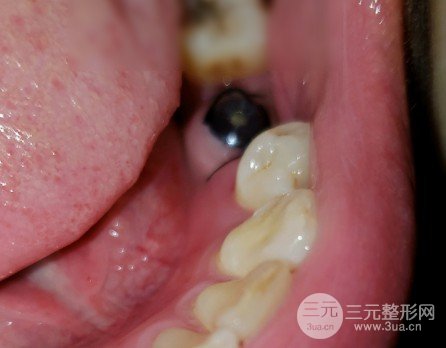 邵阳雅贝康口腔医院价目表