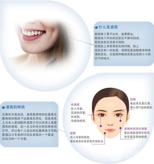 酒窝成型手术方法