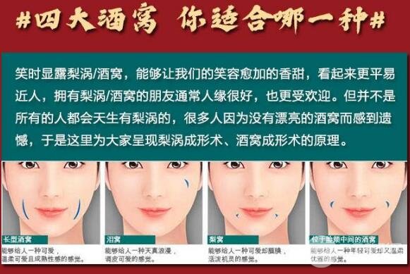 酒窝成型手术方法