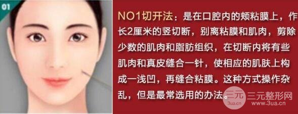 酒窝成型手术方法