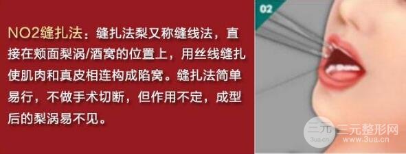 酒窝成型手术方法