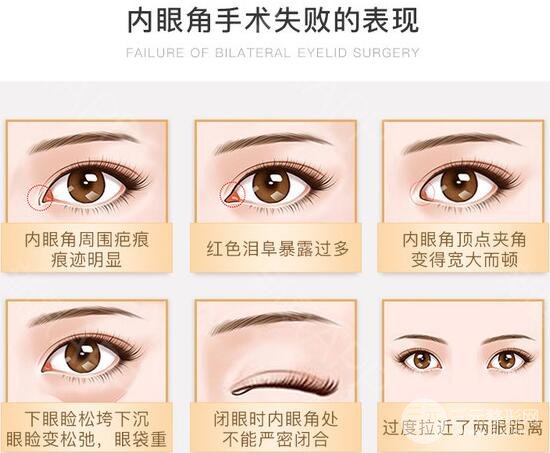 开眼角留疤较严重图片