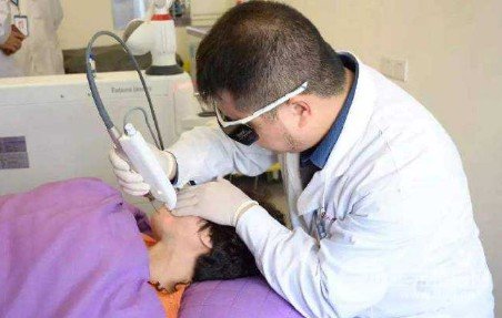 激光可以去除黄褐斑吗