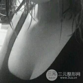 手术后三周的情况介绍
