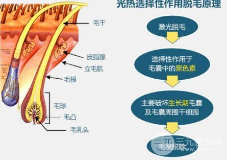 激光脱毛后还会长吗