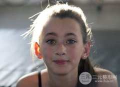 激光祛斑会不会反弹?万一反弹了要怎么办?