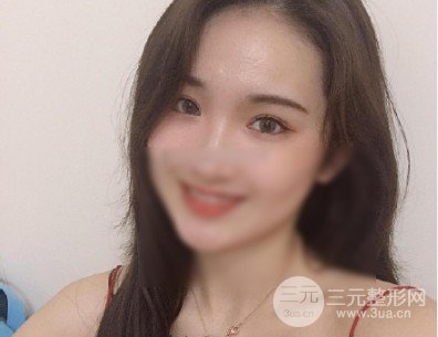 开眼角手术风险大吗