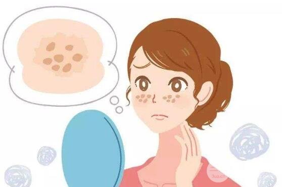 光子祛斑有副作用吗?