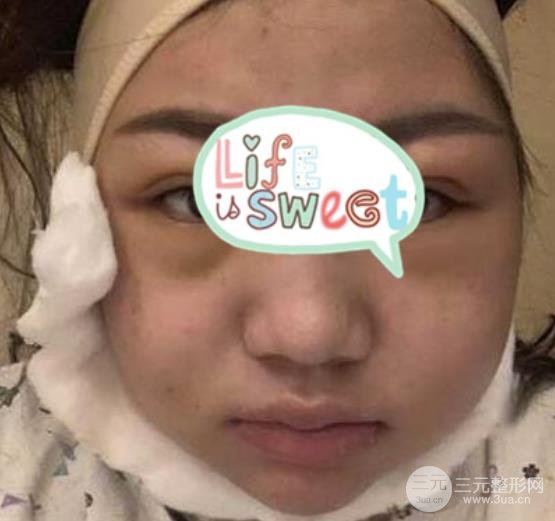 [测评]上海市嘉定区安缦医疗美容好吗？附6月价格表一览&案例图~