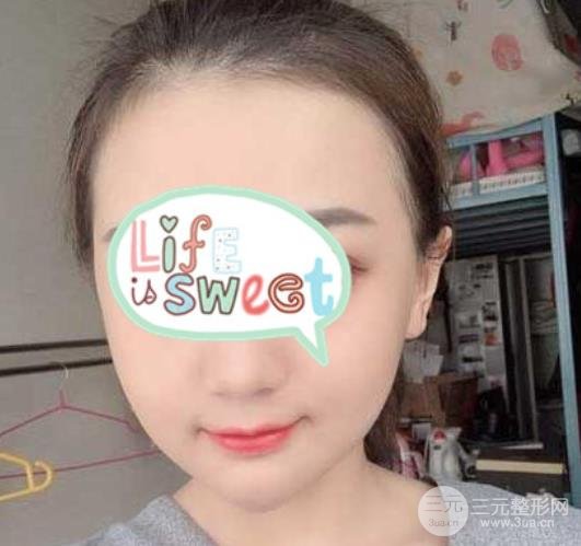[测评]上海市嘉定区安缦医疗美容好吗？附6月价格表一览&案例图~