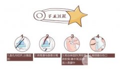 肋软骨隆鼻会吸收吗?哪些情况下容易吸收? 肋软骨隆鼻会吸收吗?哪些情况下容易吸收?